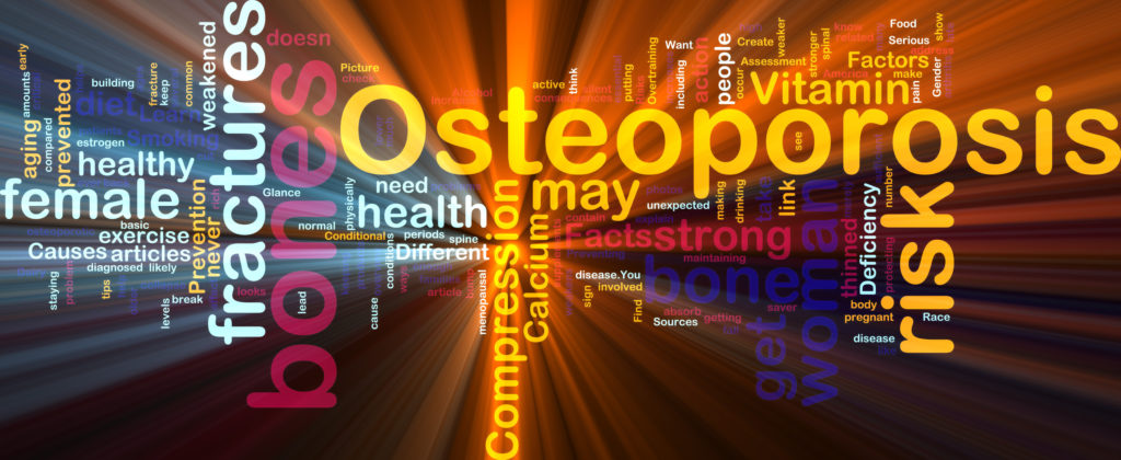 Word,Cloud,Concept,Illustration,Of,Bone,Osteoporosis,Glowing,Light,Effect